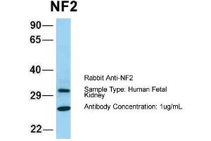 Host: Rabbit  Target Name: NF2  Sample Tissue: Human Fetal Kidney  Antibody Dilution: 1.