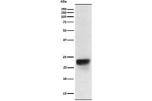 Western blot analysis of FSH beta expression in Human pituitary lysate.