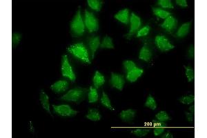 Immunofluorescence of monoclonal antibody to CNO on HeLa cell. (BLOC1S4 抗体  (AA 108-217))