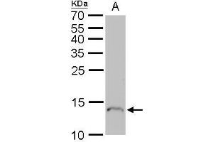 WB Image Profilin 1 antibody detects Profilin 1 protein by Western blot analysis. (PFN1 抗体)