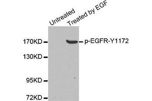 Western blot analysis of extracts from A431 cells, using Phospho-EGFR-Y1172 antibody. (EGFR 抗体  (pTyr1172))