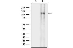 anti-Lemur Tyrosine Kinase 3 (LMTK3) (Internal Region) antibody