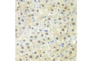 Immunohistochemistry (Paraffin-embedded Sections) (IHC (p)) image for anti-Proteasome (Prosome, Macropain) 26S Subunit, Non-ATPase, 13 (PSMD13) (AA 1-250) antibody (ABIN6146337)