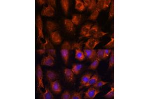 Immunofluorescence analysis of C6 cells using INPP5E antibody (ABIN7267883) at dilution of 1:100. (INPP5E 抗体  (AA 510-630))