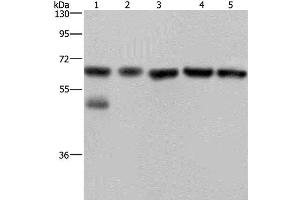 Western Blot analysis of Jurkat cell and Human brain malignant glioma tissue, PC3, K562 and A549 cell using NUP62 Polyclonal Antibody at dilution of 1:300 (NUP62 抗体)