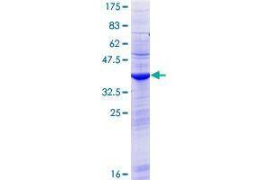 Image no. 1 for Chromosome Y Open Reading Frame 15B (CYorf15B) (AA 1-114) protein (GST tag) (ABIN1350919) (CYorf15B Protein (AA 1-114) (GST tag))