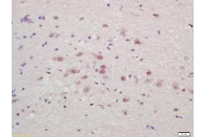 Formalin-fixed and paraffin embedded mouse brain labeled with Anti-ZNF231 Polyclonal Antibody, Unconjugated (ABIN727145) at 1:200 followed by conjugation to the secondary antibody and DAB staining