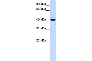 WB Suggested Anti-DGAT2L4 Antibody Titration:  0. (AWAT2 抗体  (C-Term))
