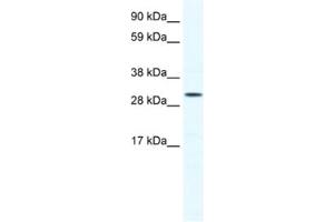 Western Blotting (WB) image for anti-SRY (Sex Determining Region Y)-Box 12 (SOX12) antibody (ABIN2460695) (SOX12 抗体)
