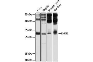 Western blot analysis of extracts of various cell lines, using EMG1 antibody (ABIN1875902) at 1:1000 dilution. (EMG1 抗体)