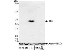 Western Blotting (WB) image for anti-CD5 (CD5) (AA 445-495) antibody (ABIN7454003)