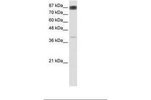 Image no. 1 for anti-Nuclear Factor of Activated T-Cells, Cytoplasmic, Calcineurin-Dependent 4 (NFATC4) (AA 241-290) antibody (ABIN6736168) (NFATC4 抗体  (AA 241-290))