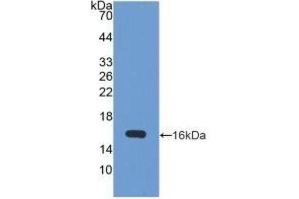 ATG7 Antikörper  (AA 429-488)