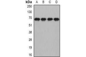 Western blot analysis of MTF-2 expression in HL60 (A), HepG2 (B), mouse brain (C), rat brain (D) whole cell lysates. (MTF2 抗体)