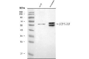 Western blot analysis of Septin 8/Septin8 using anti-Septin 8/Septin8 antibody (ABIN7602926).