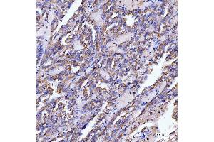 IHC analysis of SLC12A1 using anti-SLC12A1 antibody (ABIN3043925).