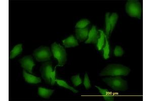 Immunofluorescence of monoclonal antibody to LGALS1 on HeLa cell. (LGALS1/Galectin 1 抗体  (AA 1-135))