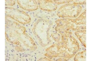 Immunohistochemistry (IHC) image for anti-Solute Carrier Family 22 (Organic Anion Transporter), Member 8 (SLC22A8) (AA 473-542) antibody (ABIN7170164)