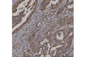 IHC analysis of FATP3/SLC27A3 using anti-FATP3/SLC27A3 antibody (ABIN7600438). (SLC27A3 抗体  (AA 192-683))