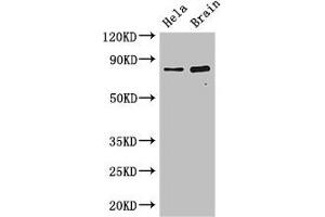 Western Blot Positive WB detected in: Hela whole cell lysate, Mouse brain tissue All lanes: DACH1 antibody at 2. (ING3 抗体  (AA 51-223))