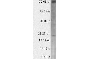 Western Blotting (WB) image for anti-Calcium Channel, Voltage-Dependent, beta 2 Subunit (CACNB2) (AA 189-205) antibody (ABIN863125)