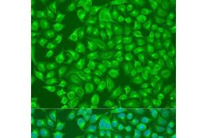 Immunofluorescence analysis of U2OS cells using SLC12A6 Polyclonal Antibody at dilution of 1:100. (SLC12A6 抗体)
