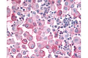 Immunohistochemistry (IHC) image for anti-Olfactory Receptor, Family 10, Subfamily J, Member 5 (OR10J5) (Extracellular Domain) antibody (ABIN1049173)