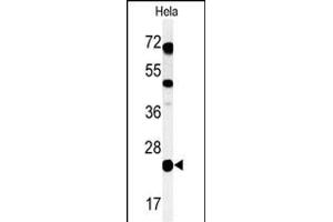 Western blot analysis of C Antibody (C-term) (ABIN650955 and ABIN2840009) in Hela cell line lysates (35 μg/lane). (C16ORF54 抗体  (C-Term))
