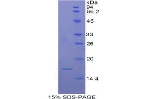 SDS-PAGE (SDS) image for ADAM Metallopeptidase with Thrombospondin Type 1 Motif, 7 (ADAMTS7) protein (ABIN3008057)