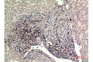 Immunohistochemistry (IHC) analysis of paraffin-embedded Human Liver, antibody was diluted at 1:100. (IFITM1 抗体  (N-Term))