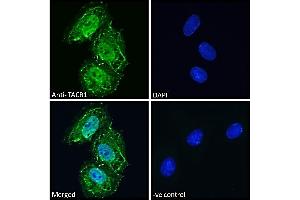 (ABIN190795) Immunofluorescence analysis of paraformaldehyde fixed Neuro2a cells, permeabilized with 0. (TACR1 抗体  (Internal Region))