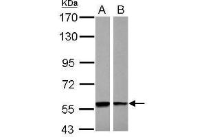 WB Image Sample (30 ug of whole cell lysate) A: A431 B: Raji 7. (PHGDH 抗体)