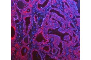 IF analysis of Cytokeratin 8/KRT8 using anti-Cytokeratin 8/KRT8 antibody (ABIN5518853).