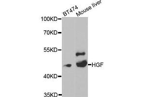 Western blot analysis of extracts of various cell lines, using HGF antibody. (HGF 抗体  (AA 30-285))