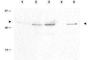 Western blot using  Affinity Purified anti-Cyclin B1 pS126 antibody shows detection of a band ~48 kDa corresponding to phosphorylated human Cyclin B1 (arrowheads) in various whole cell lysates. (Cyclin B1 抗体  (pSer126))