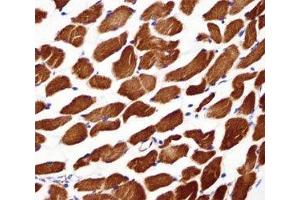 Alpha Actin antibody immunohistochemistry analysis in formalin fixed and paraffin embedded human skeletal muscle (Actin 抗体  (AA 346-375))