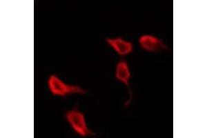 ABIN6278696 staining Hela by IF/ICC. (VZV Protein kinase ORF47 抗体)