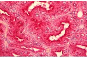 ABIN625823 (5µg/ml) staining of paraffin embedded Human Kidney.