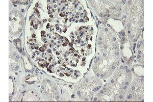 Image no. 4 for anti-Methionyl Aminopeptidase 2 (METAP2) (AA 2-212) antibody (ABIN1491153)