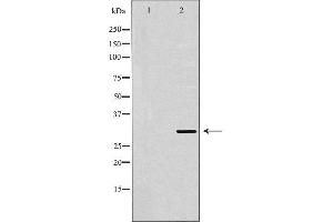 Western blot analysis of extracts of mouse spleen , using FCER1A antibody. (Fc epsilon RI/FCER1A 抗体  (C-Term))