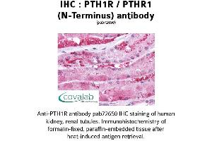 Image no. 1 for anti-Parathyroid Hormone 1 Receptor (PTH1R) (Extracellular Domain), (N-Term), (pThr1) antibody (ABIN1738580) (PTH1R 抗体  (Extracellular Domain, N-Term, pThr1))