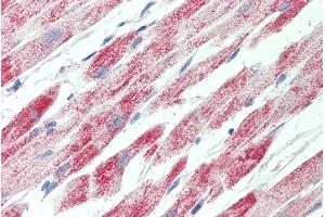 Immunohistochemistry (IHC) image for anti-ATP Synthase, H+ Transporting, Mitochondrial F1 Complex, gamma Polypeptide 1 (ATP5C1) (C-Term) antibody (ABIN2613390)