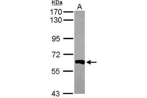 Western Blot analysis: AP19061PU-N PPP3CB antibody staining of Mouse Brain whole cell lysate, 7. (PPP3CB 抗体)