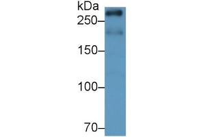 Detection of mTOR in Rat Cerebrum lysate using Monoclonal Antibody to Serine/threonine-protein kinase mTOR (mTOR) (MTOR 抗体  (AA 2226-2488))