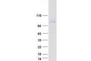 Western Blotting (WB) image for rho-Related BTB Domain Containing 1 (RHOBTB1) (Transcript Variant 1) protein (Myc-DYKDDDDK Tag) (ABIN2730846)