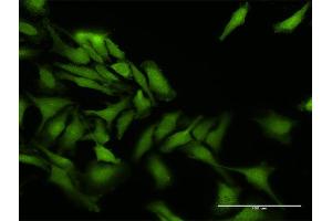 Immunofluorescence of purified MaxPab antibody to PPEF1 on HeLa cell. (PPEF1 抗体  (AA 1-653))
