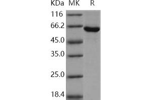 Western Blotting (WB) image for Sphingosine Kinase 1 (SPHK1) protein (GST tag,His tag) (ABIN7317044) (SPHK1 Protein (GST tag,His tag))