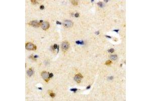 Immunohistochemical analysis of Plasma Kallikrein HC staining in human brain formalin fixed paraffin embedded tissue section. (KLKB1 抗体  (Heavy Chain))