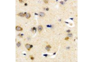 Immunohistochemical analysis of Plasma Kallikrein HC staining in human brain formalin fixed paraffin embedded tissue section.
