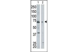 The anti-GGA1 Pab (ABIN389018 and ABIN2839239) is used in Western blot to detect GGA1 in mouse kidney tissue lysate (lane 1) and Jurkat cell lysate (lane 2). (GGA1 抗体  (N-Term))
